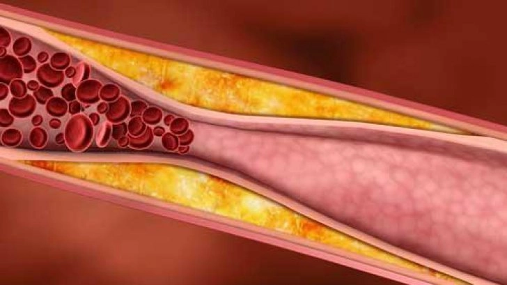 media-146260413828977500