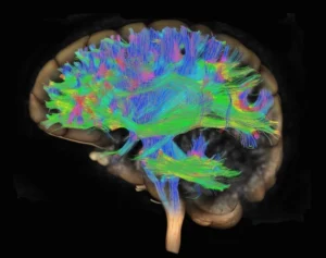 media-166377205451573000