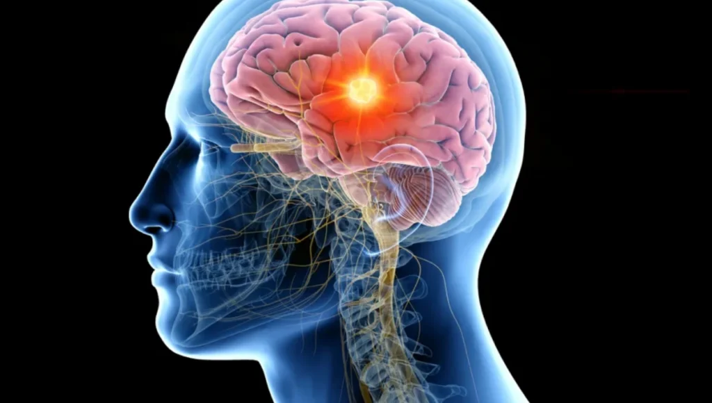 media-174450735921601700-1